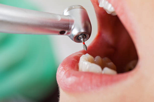 Randleman, NC Emergency Dentist Pros